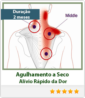 Técnicas Avançadas de Agulhamento